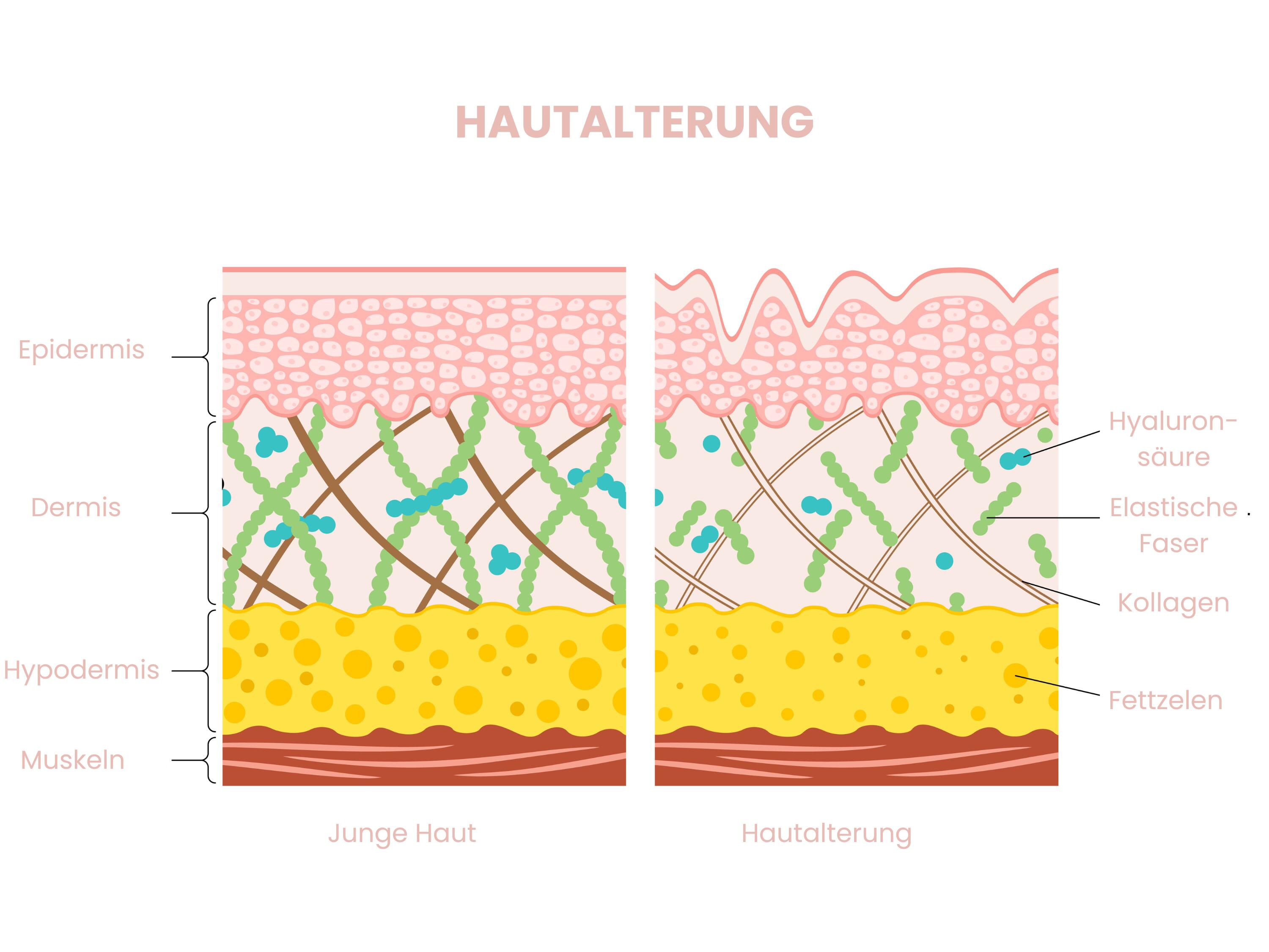 Die Infografik zeigt den Vergleich zwischen junger und alternder Haut, bei der mit zunehmendem Alter Kollagen, elastische Fasern und Hyaluronsäure abnehmen und die Hautstruktur dünner sowie unregelmäßiger wird.